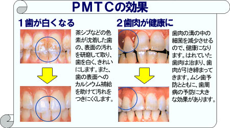 1.クリーニング