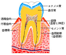 歯槽骨が溶けてしまう病気が歯周病