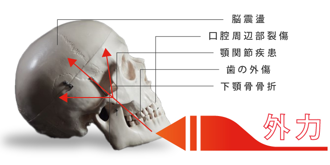 下顎骨に外力が加わると歯や顎の損傷だけではなく頭蓋にも影響を及ぼします